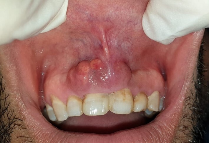 autopsy-13-e2023463-g01.jpg