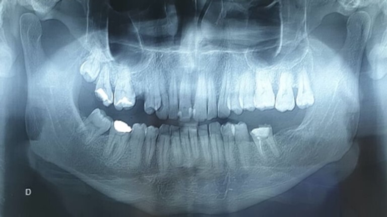autopsy-13-e2023463-g02.jpg