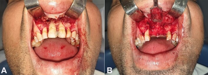 autopsy-13-e2023463-g06.jpg