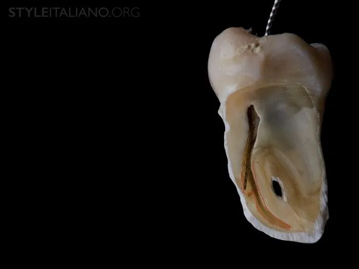 根管治疗台阶的预防和处理